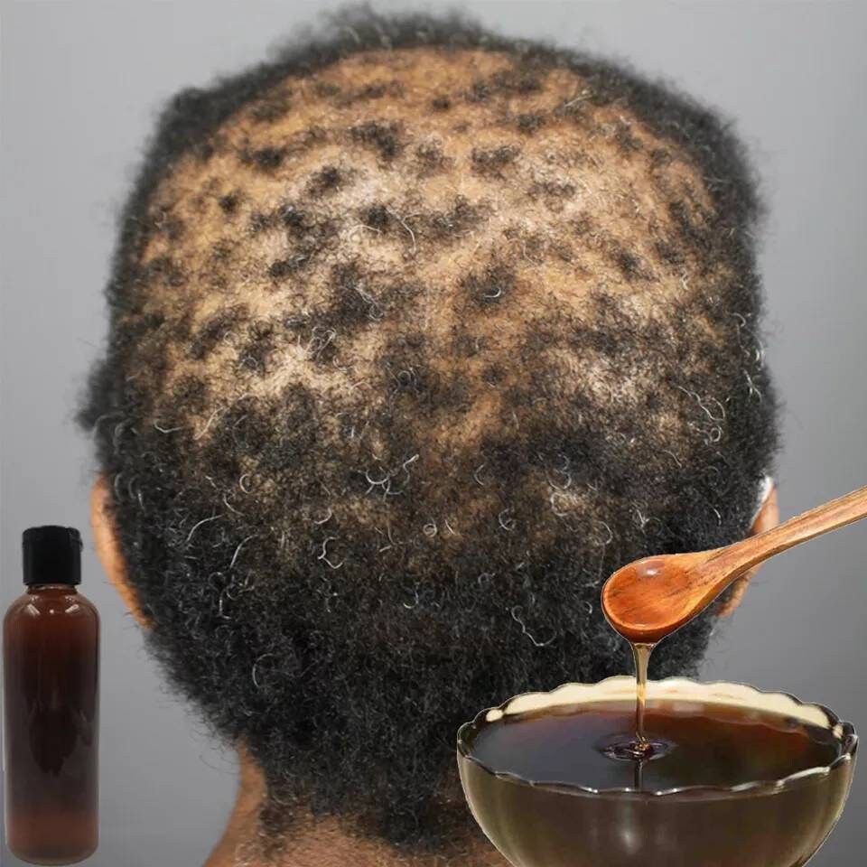 Fast Hair Growth Shampoo Alopecia Hair Loss Treatment Chebe Powder